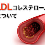 LDLコレステロール
