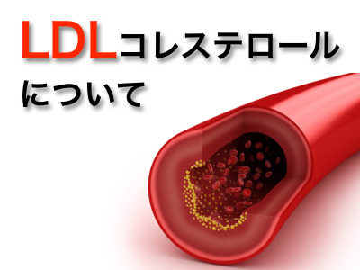LDLコレステロール