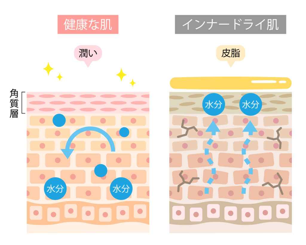 健康な肌とインナードライ肌を示した図